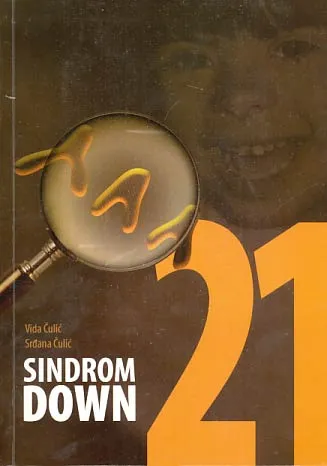 Sindrom Down
