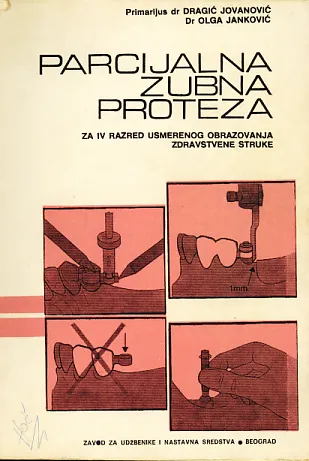 Parcijalna zubna proteza