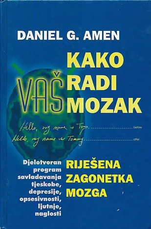 Kako radi vaš mozak