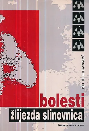 Bolesti žlijezda slinovnica
