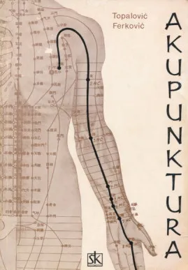Akupunktura