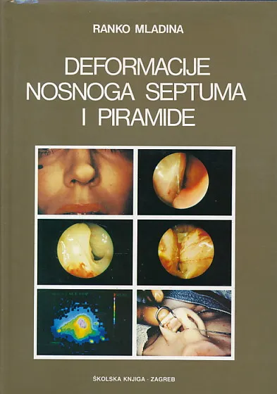 Deformacije nosnoga septuma i piramide