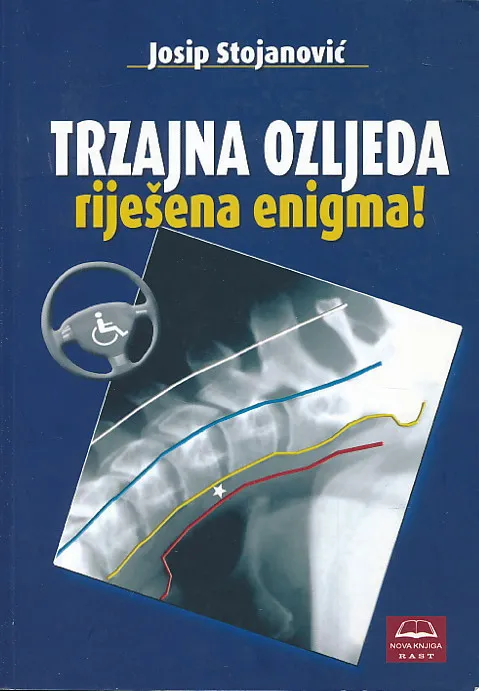 Trzajna ozljeda riješena enigma