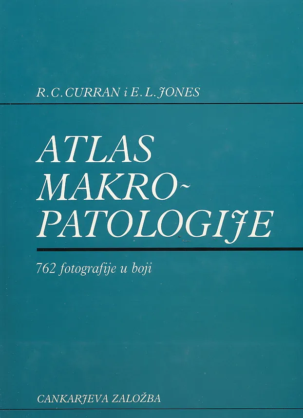 Atlas makropatologije