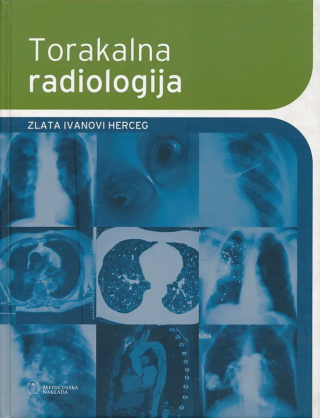 Torakalna radiologija