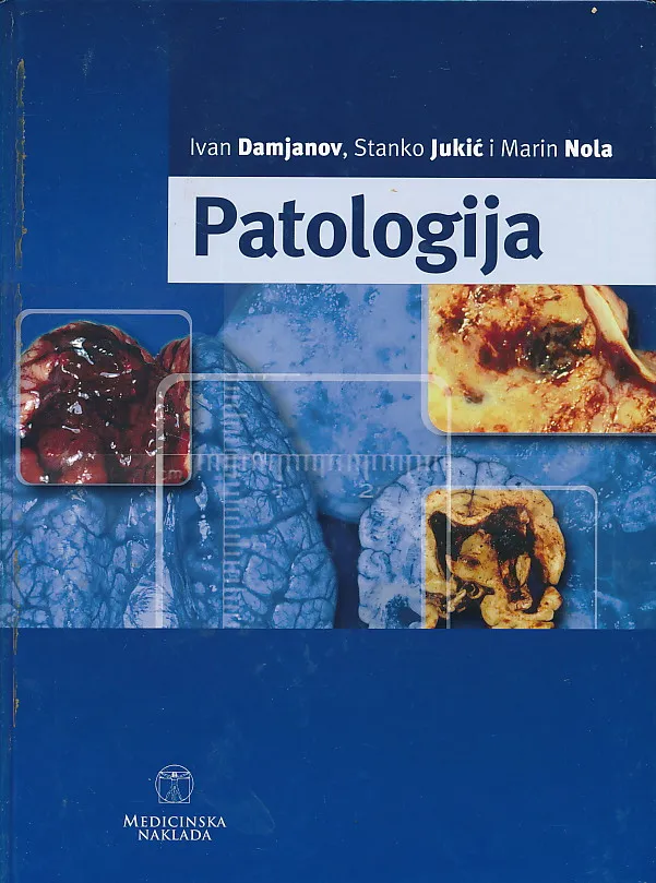 Patologija