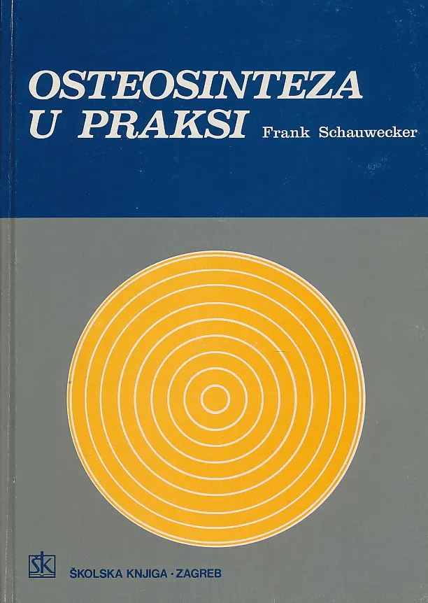 Osteosinteza u praksi