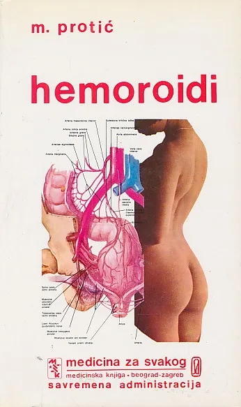 Hemoroidi