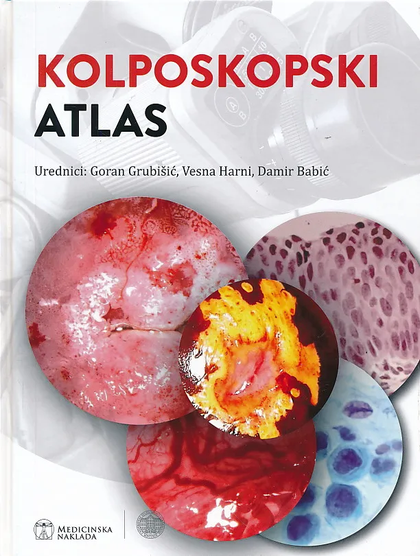 Kolposkopski atlas