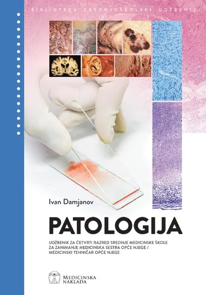 Patologija udžbenik za četvrti razred srednje medicinske škole za zanimanje medicinska sestra opće njege/medicinski tehničar opće njege