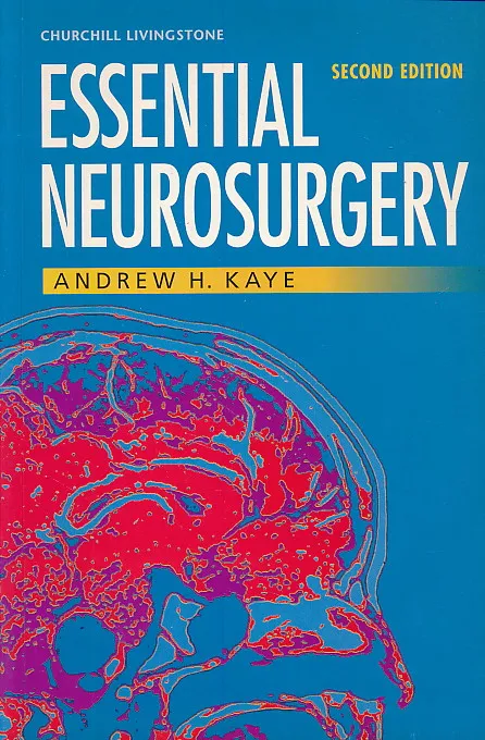 Essential Neurosurgery